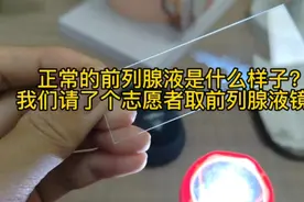 正常的前列腺液是什么样子？我们请了个志愿者取了前列腺液镜检。视频封面