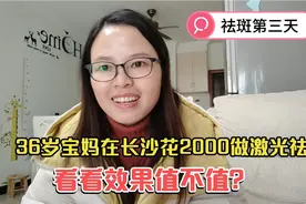 36岁宝妈在长沙三甲医院做激光祛斑，2000一次，看看效果值不值？视频封面