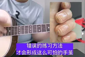 错误的练习方法，会导致你的手茧异于常人！