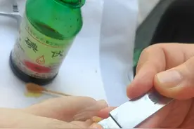 这个初中生甲沟炎拖了一年，甲床两边长了两坨息肉。严重变形。视频封面