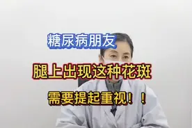 糖尿病朋友腿上出现这种花斑，需要提起重视！！视频封面