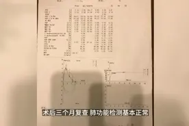 双肺多发磨玻璃结节肺癌一网打尽，术后肺功能检测正常视频封面