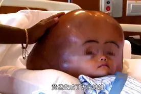 当时喝三鹿奶粉被毒的孩子们现在怎么样了视频封面