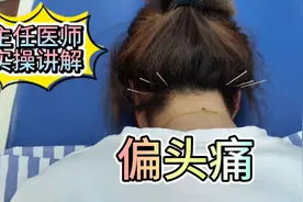 病案分享：偏头痛治疗思路讲解，治风要穴风池穴，针灸实操讲解！视频封面