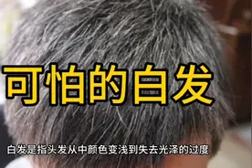 可怕的白发，不得不重视视频封面
