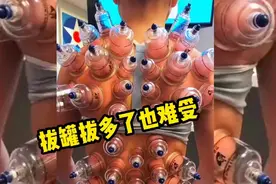拔罐拔的真多，拔多了也难受，疼啊！视频封面