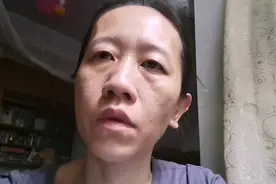 如果摔伤了，骨折，会去综合医院还是专科医院治疗视频封面