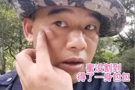 石锅锅和老良去割蜂蜜，蜂蜜没割到，老良被叮起了几十个包包视频封面