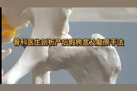 骨科医生剖析产后假胯宽及复原手法视频封面