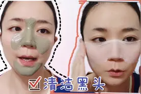 这样清洁黑头毛孔，肉眼可见的效果，黑头变少毛孔收缩了视频封面