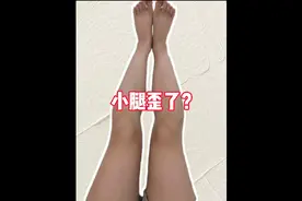 【XO型腿】胫骨相对股骨过度外旋！完整矫正训练教程！