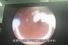 经尿道前列腺电切术视频封面