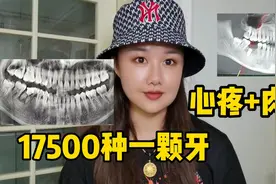 在海口花17500种了一颗牙，真是花钱找罪受，手术经历不敢回忆。视频封面