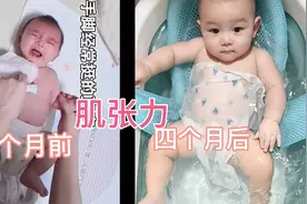 6个月肌张力高的早产宝宝 经历5个月的康复按摩 前后对比视频封面