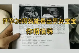 怀孕20周就能知道男宝宝还是女宝宝，你敢相信嘛视频封面