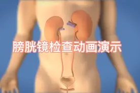 膀胱疾病诊断利器，膀胱镜检查动画演示！