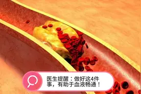 血液粘稠怎么调理好？医生提醒：做好这4件事，有助于血液畅通视频封面