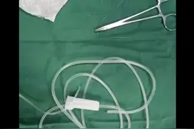 简易一次性使用负压吸引治疗视频封面
