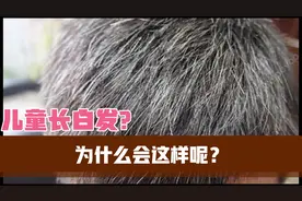 小小儿童长白发怎么了呢？视频封面