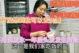 头屑多头皮痒掉发多用一土货渣渣加盐，4个月发际线往下移2毫米视频封面