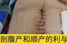 顺产和剖腹产各有利弊在能顺产的情况下尽量顺产新生儿健康聪明。视频封面