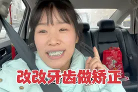 改改牙齿做矫正，耗时两年，费用7000元！婆婆说：原来牙齿也挺好