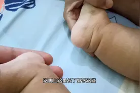 五个月的宝宝身上长了好多小痘痘很痒，去医院检查就说要抽血，烦视频封面