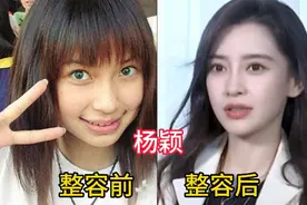 整容最不后悔的10位女星，杨颖 李冰冰 赵丽颖等，来看看谁最成功视频封面