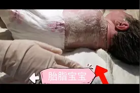 胎脂是早产宝宝的专利？足月的宝宝出生后就一定没有胎脂视频封面