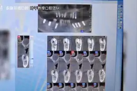 上颌窦囊肿微创摘除术视频封面