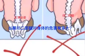 翘二郎腿很舒服，但你知道长期翘二郎腿对身体的危害有多大吗？视频封面