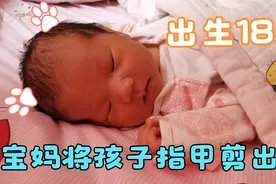 宝妈不小心剪破了孩子的手，看着宝宝的小手流血内心自责又内疚视频封面