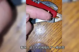 竹签扎穿手指头，直接用钳子拔，是个狠人视频封面
