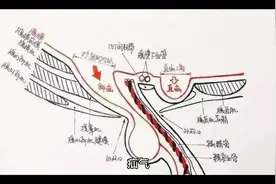 疝气不开刀，药敷掌心即可治愈