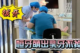 为什么现在小孩换牙这么难，多生牙，双排牙，上医院去拔一百一颗视频封面