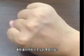 为何有人手上的青筋凸起？青筋多说明了什么问题？视频封面