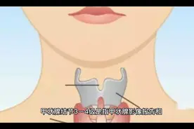 彩超检查甲状腺结节3～4级是什么意思？