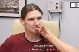 挤痘大师—帅哥的脸上多出一块儿，李医生挤出浓浓燕麦粥～视频封面