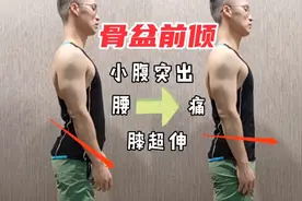 小腹突出、腰痛、膝超伸，4招纠正骨盆前倾！视频封面