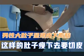 男性大肚子却呈现出皮下脂肪堆积，这样瘦下去要切皮，超级肥胖！视频封面