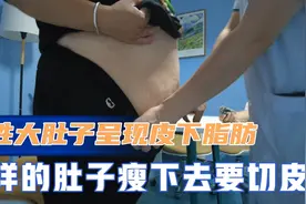 男性大肚子却呈现出皮下脂肪堆积，这样瘦下去要切皮，超级肥胖！视频封面