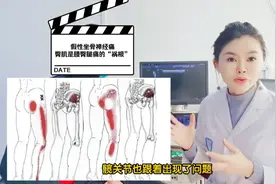 大转子、下肢痛～不一定是腰的问题～石博士为您讲解臀中肌综合征