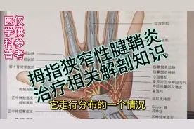 拇指狭窄性腱鞘炎，实用基础解剖知识，简单易懂。视频封面