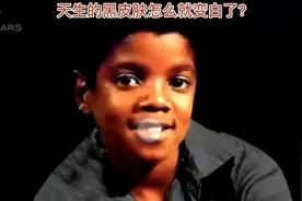 迈克尔杰克逊天生的黑皮肤怎么变白的？视频封面