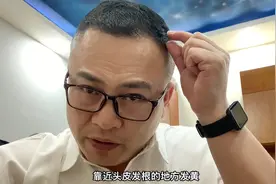 染闷青色为什么头顶发黄，是什么原因、怎么解决？视频封面