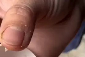 经常吃鸡蛋缺很少人知道鸡蛋内层膜的妙用@贵州晓晓9211视频封面