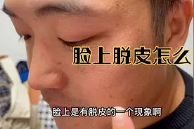 冬天好多人脸上出现了脱皮的现象，来看心浠小姨怎么做视频封面