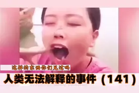人类无法解释的事件（141）被章鱼吸在脸上的女子，你敢这样做吗