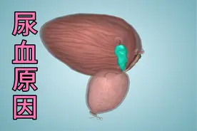 尿道出血是什么原因导致的？应该做哪些检查？视频封面