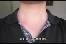 为什么美国南部的老白人，被人们叫做“红脖子”？